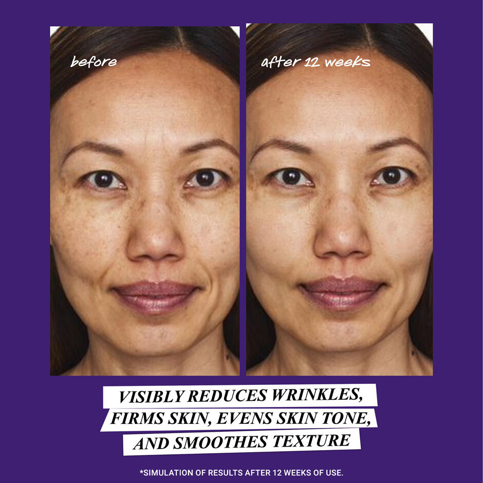 Retinol before top and after